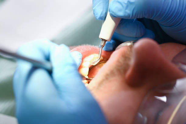Best Same-Day Emergency Dentist in San Saba, TX