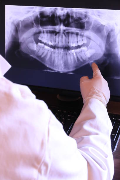 Best Walk-In Emergency Dentist in San Saba, TX