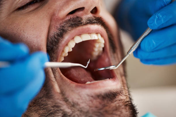 Best Same-Day Emergency Dentist in San Saba, TX